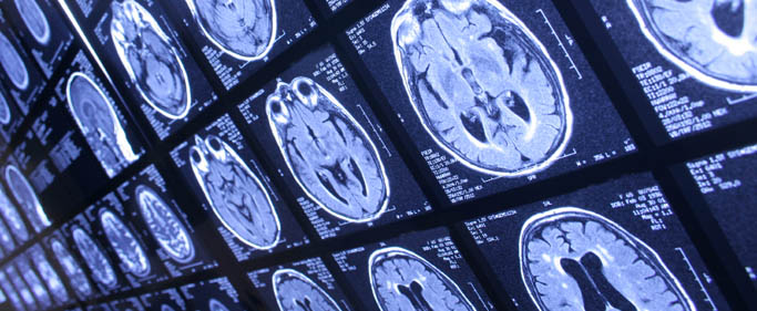 Radiation-Therapy WideShot(Cropped)