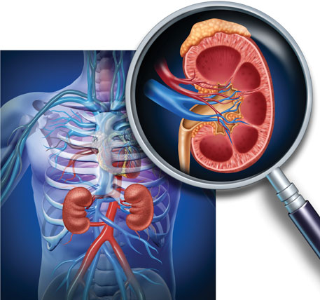 Mass kidney failure in Sri Lanka is a sign of wider systemic failure in land and water care